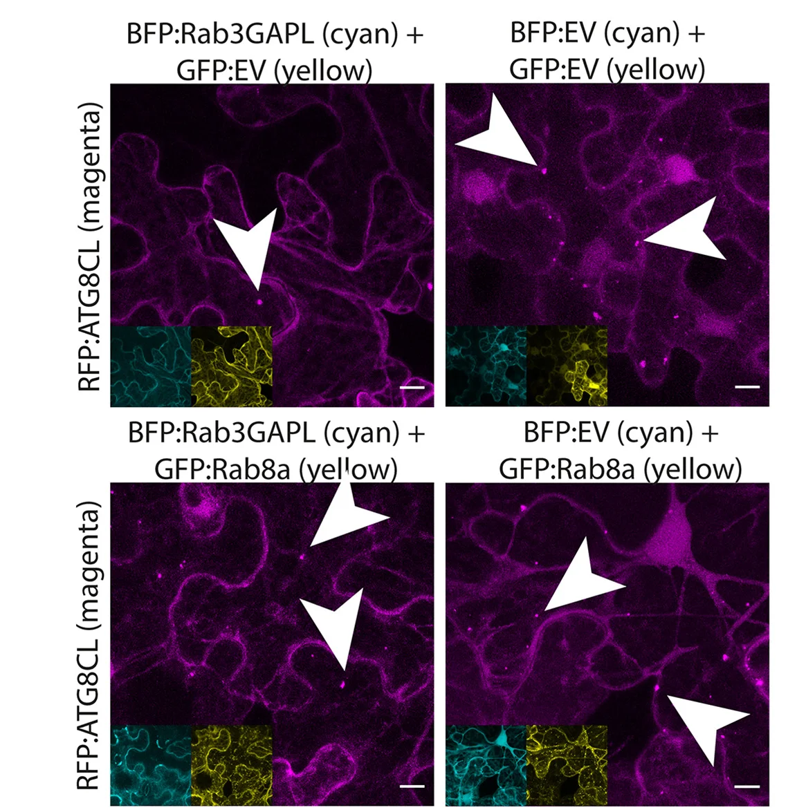 Open access visualization of Microscopy, Rab8a, Rab3GAPL, Autophagosome, Confocal Micrographs