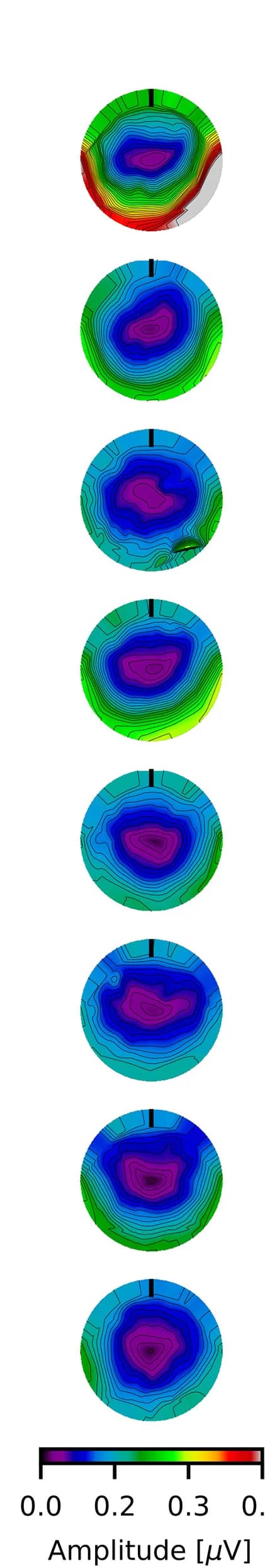 Open access visualization of Heatmap, Topographic Map, EEG, Brain