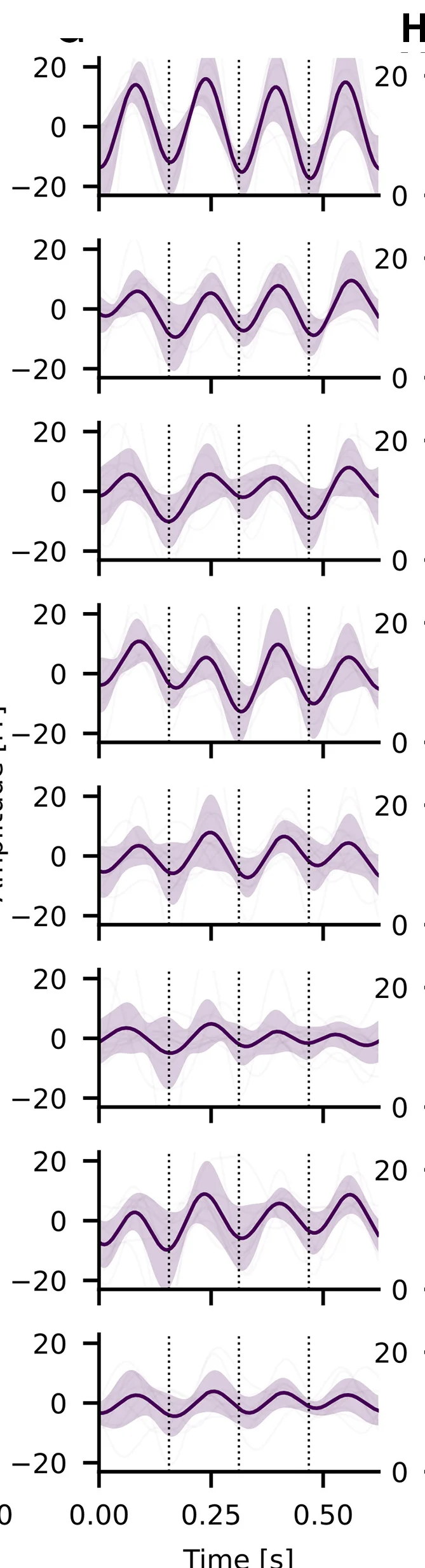 Open access visualization of Line Plot, Error Bars, Time Domain, MEG, Brain