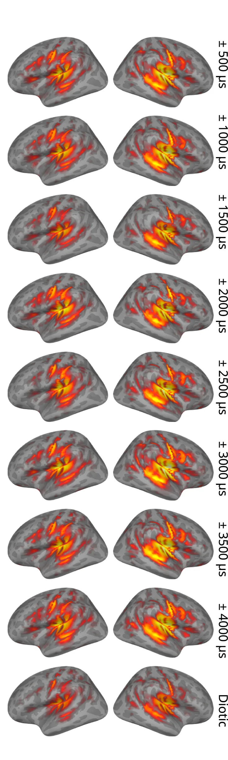 Open access visualization of Heatmap, MEG, Statistical Parametric Map, SPM, Anatomical Regions