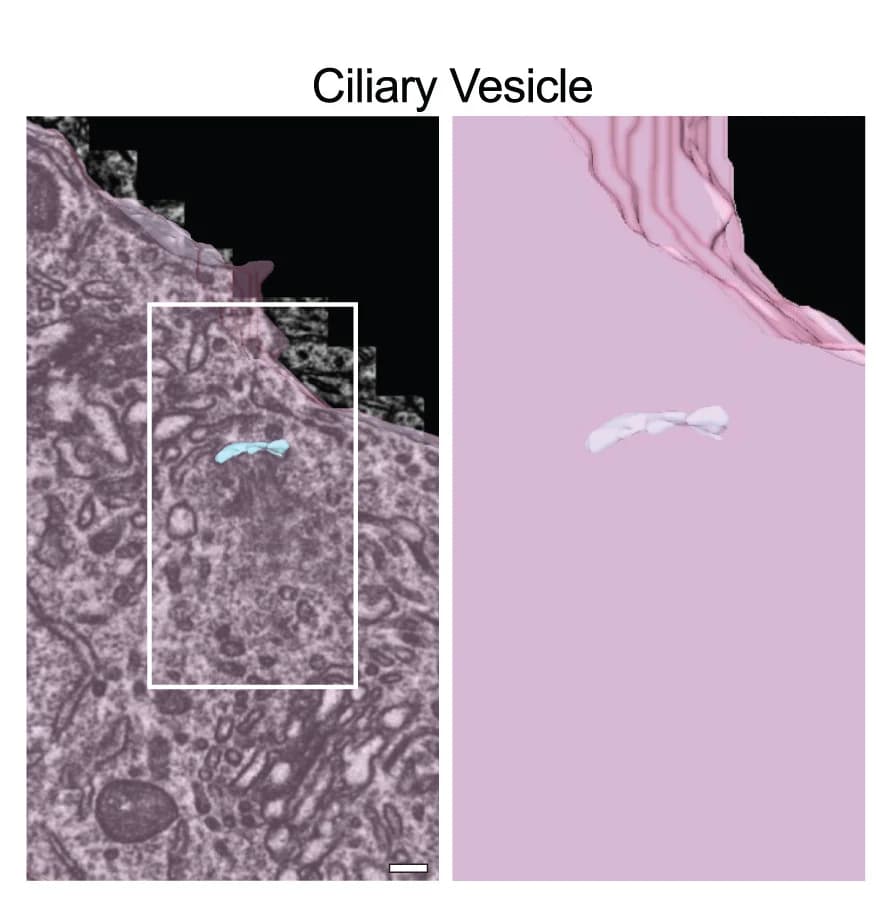 Open access visualization of Microscopy, Ciliary Vesicle, EM