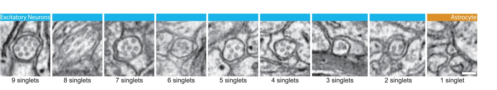 Open access visualization of Microscopy, Cilia, Cross-sections, Microtubule Configuration, Cilium Tips