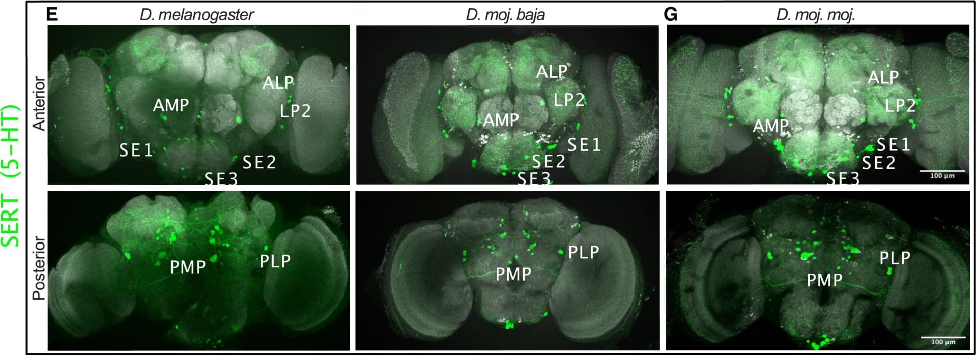 Open access visualization of Microscopy, Immunostaining, SERT, Brain, D. moj.baja