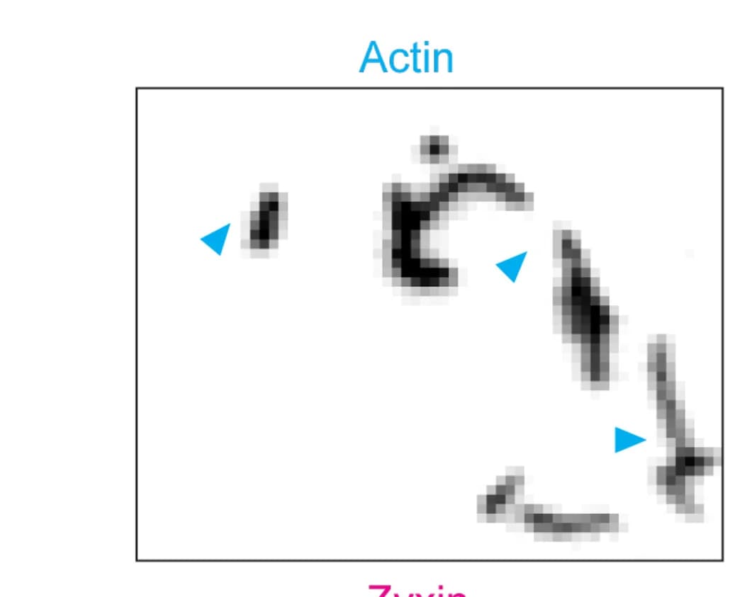 Open access visualization of Microscopy, TIRF, Actin Filaments, Zyxin, Myosin