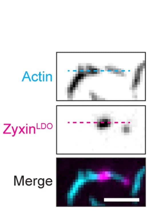 Open access visualization of Microscopy, TIRF, Zyxin, Bridge