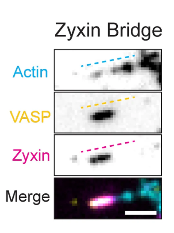 Open access visualization of Microscopy, Zyxin Bridge, VASP, Detail View