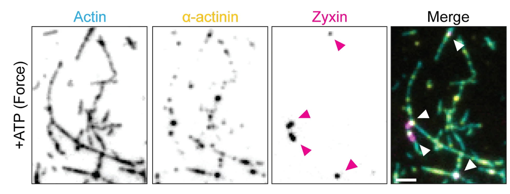 Open access visualization of Microscopy, TIRF, Alpha-actinin Clusters, Zyxin Patches, Actin Filaments