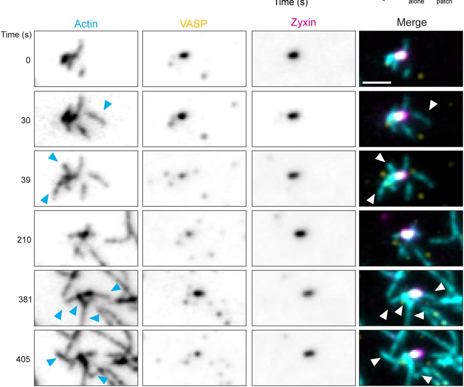 Open access visualization of Microscopy, Actin Filaments, Hypermol ATTO 488, VASP, Zyxin
