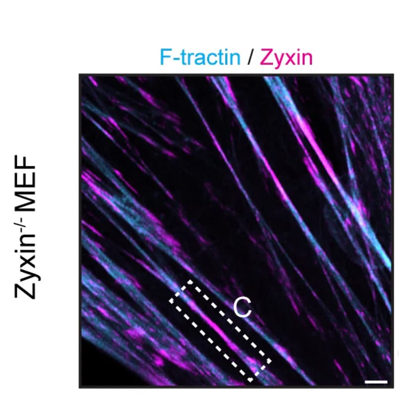 Open access visualization of Microscopy, Airyscan Image, Zyxin, MEFs, F-tractin-mScarlet