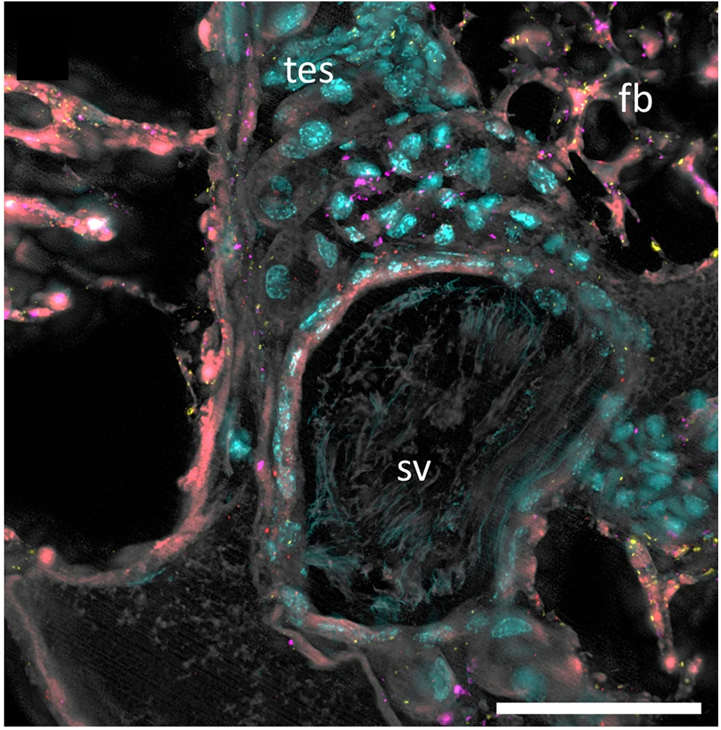 Open access visualization of Microscopy, Adult Male, SodalisSC, Wolbachia, Rickettsia