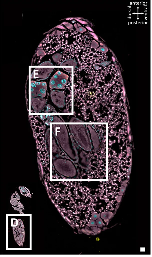 Open access visualization of Microscopy, Adult Female, Wolbachia, Rickettsia, Ovarian Nurse Cells