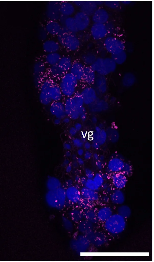 Open access visualization of Microscopy, Sodalis SC, Venom Gland