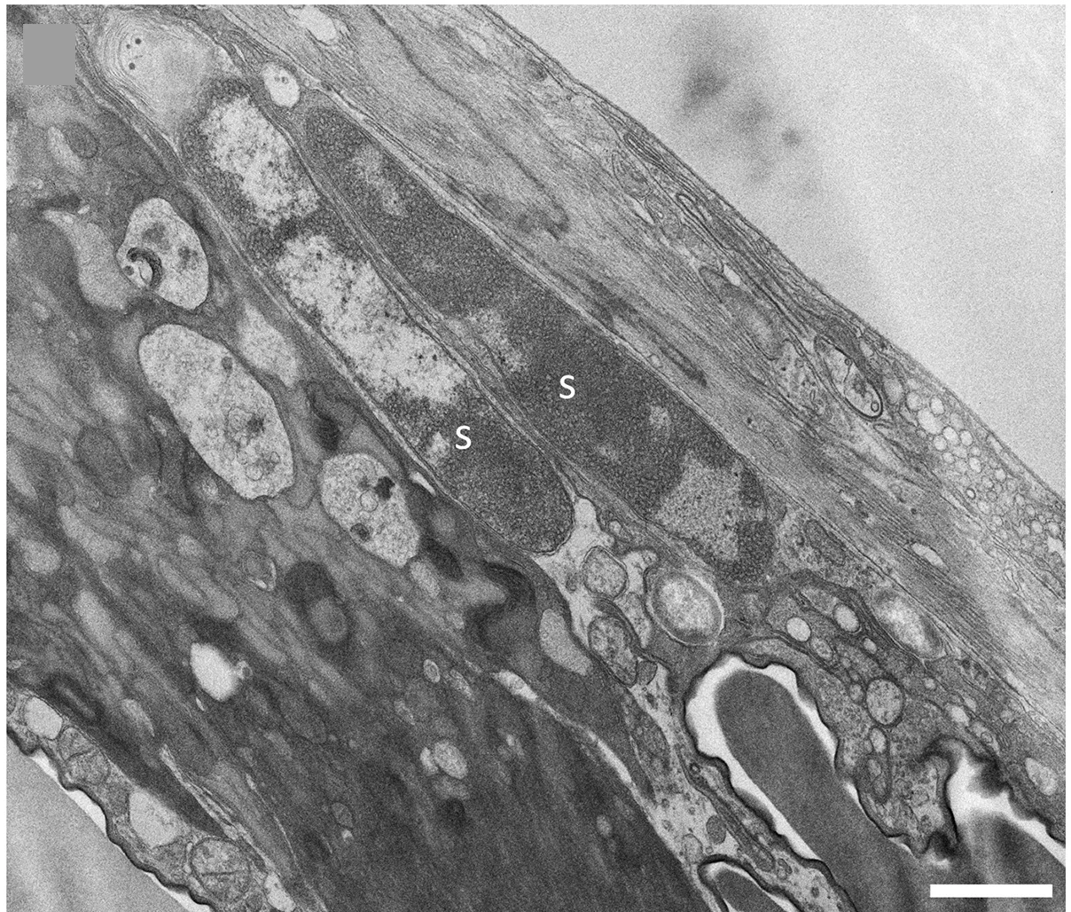 Open access visualization of Microscopy, TEM, Sodalis SC, Venom Reservoir Cells, Muscle Cells