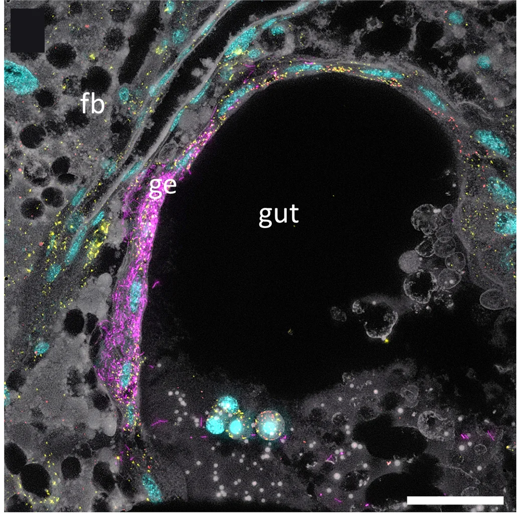 Open access visualization of Microscopy, Pupa, Sodalis SC, Wolbachia, Rickettsia