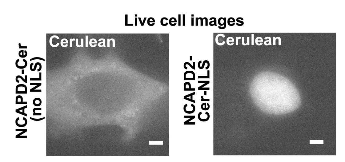Open access visualization of Microscopy, Live-Cell Visualization, NCAPD2-Cerulean, Nuclear Localization Signal, HT-1080 Cells