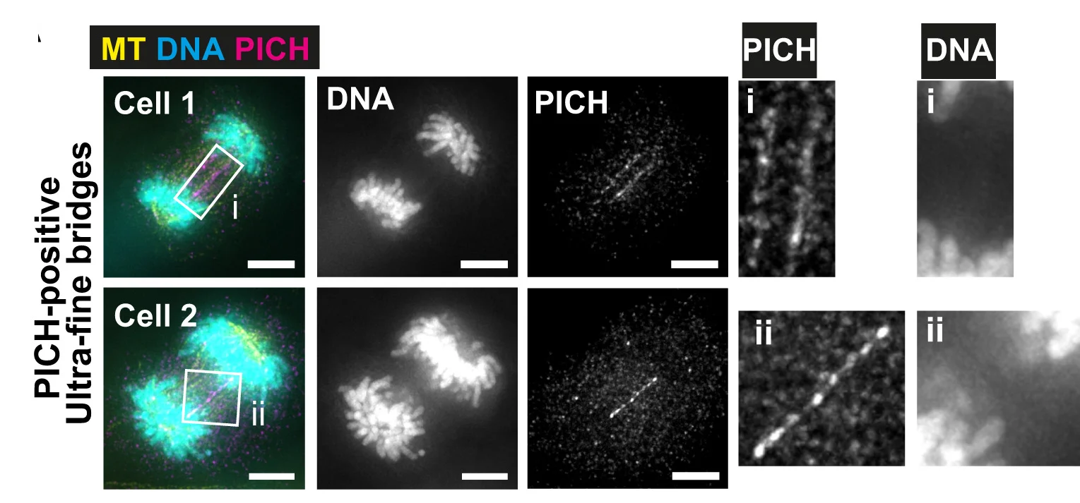 Open access visualization of Microscopy, Immunofluorescence, PICH, Chromosomes, DAPI
