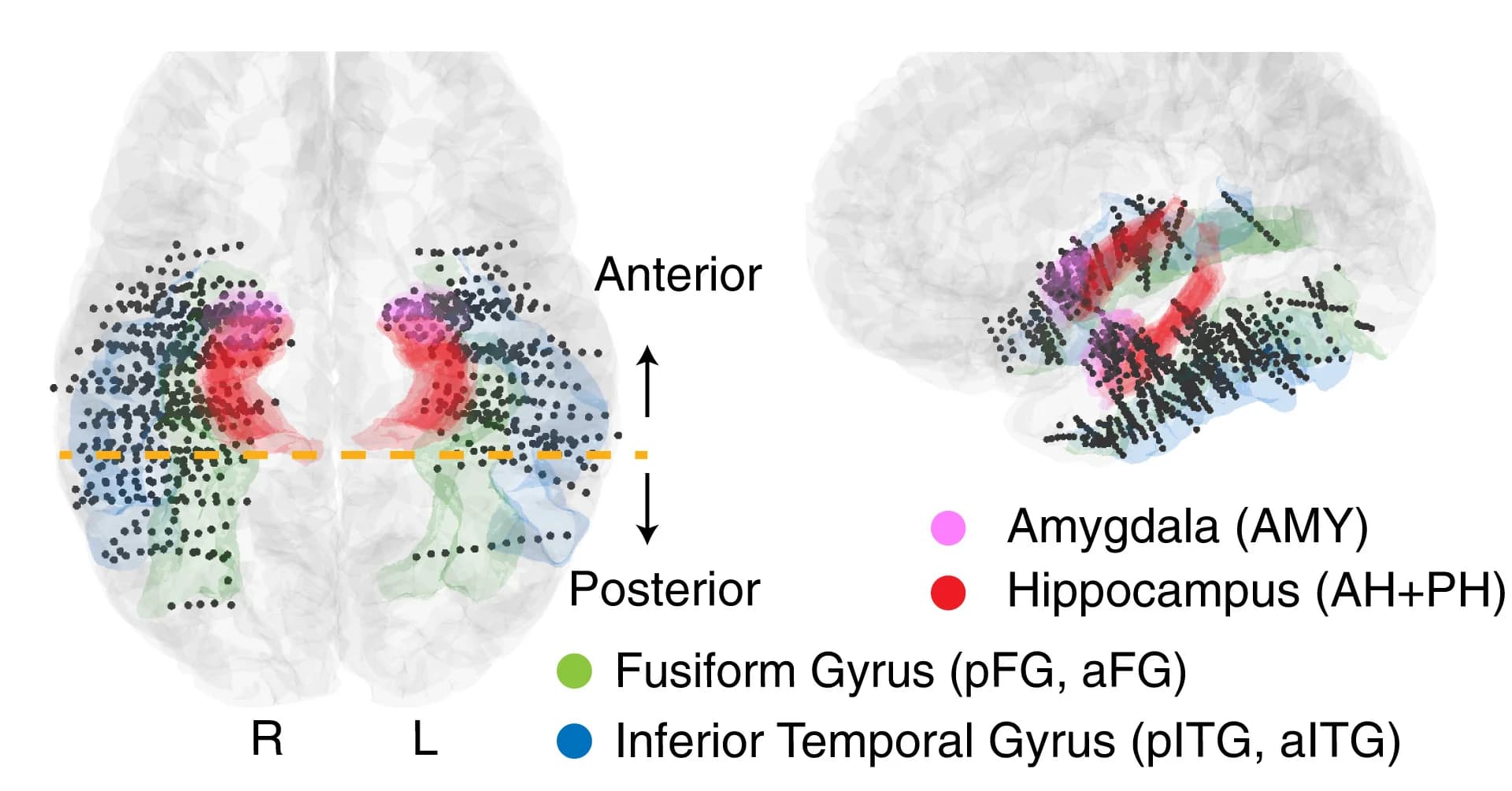 Open access visualization of 3D Plot, iEEG Recordings, MNI Brain Space, Regions of Interest