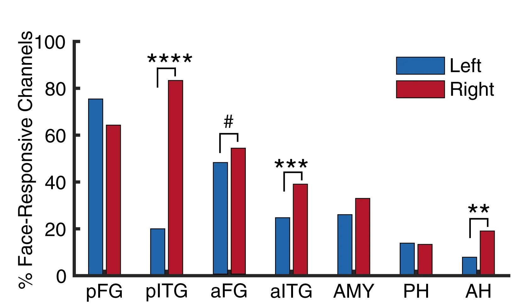 Open access visualization of Clustered, Bar Plot, Visually Responsive Channels, Regions of Interest, Left Hemisphere