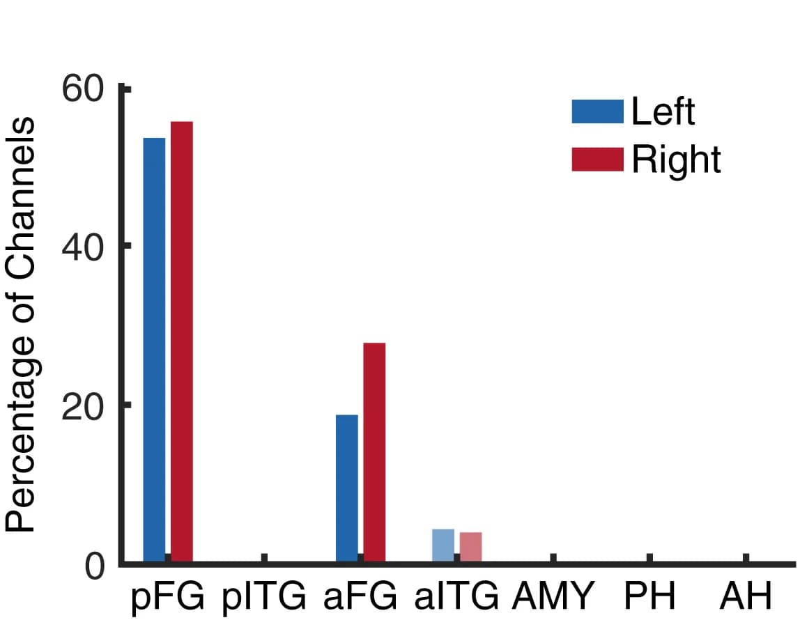Open access visualization of Bar Plot, Clustered, Axis Coding, Channels, Regions of Interest