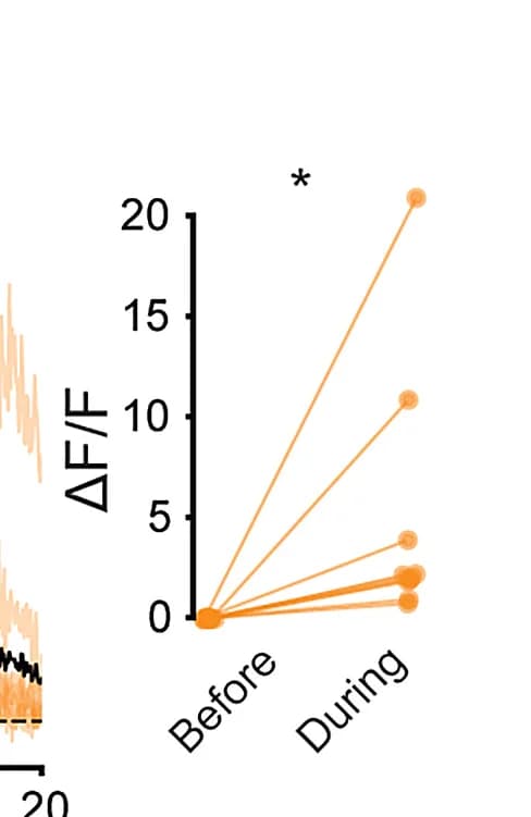 Open access visualization of Line Plot, Scatter Plot, ΔF/F, Stimulation, Wilcoxon Signed-Rank Test