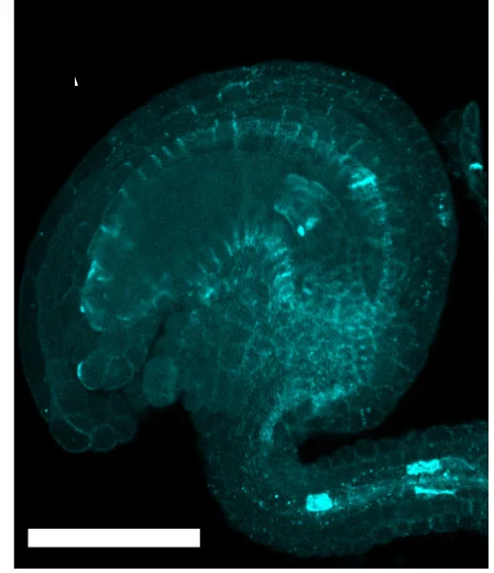 Open access visualization of Microscopy, Aniline Blue Staining, Ovules, No Pollen Tubes
