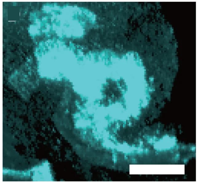 Open access visualization of Microscopy, Callose Deposition, gcs1