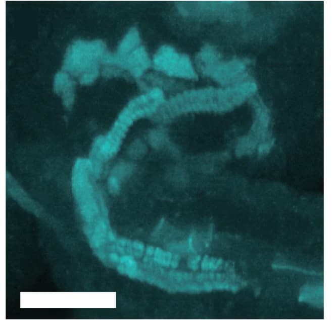 Open access visualization of Microscopy, Callose Deposition, Atbg_ppap, Xylem