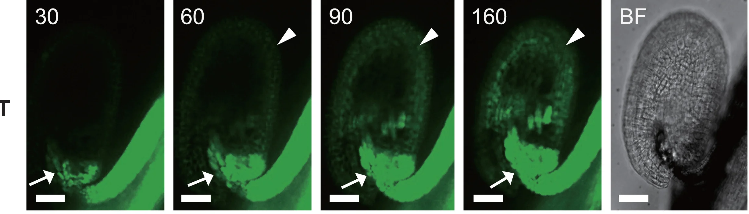 Open access visualization of Microscopy, Photo, Live-Cell Imaging, CF Dye Tracer, Bright Field