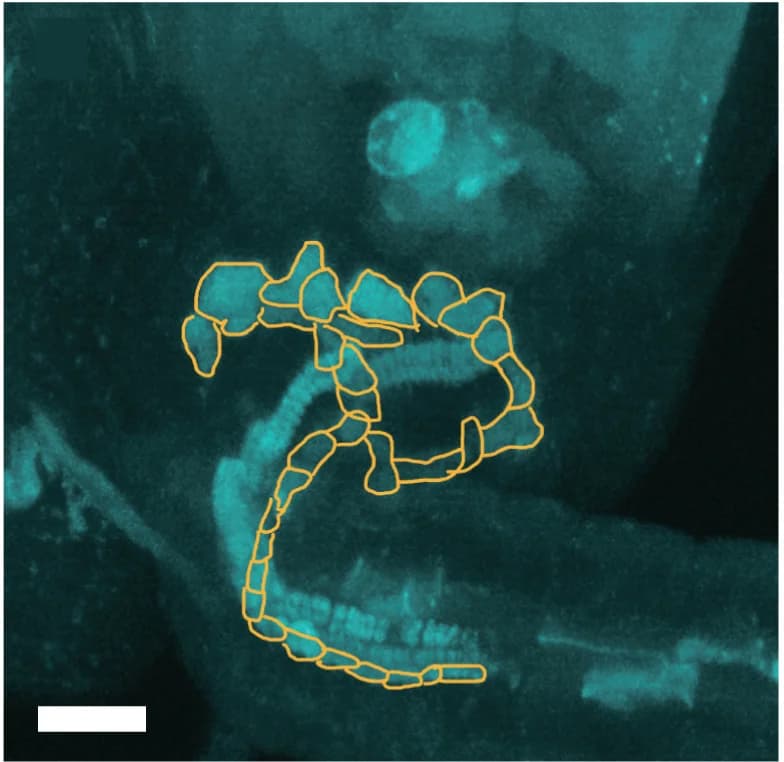 Open access visualization of Microscopy, WT, Chalazal End, Callose Stain, PE Cells