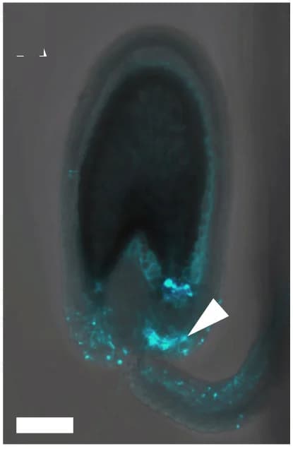 Open access visualization of Microscopy, Aniline Blue Staining, Double Fertilization