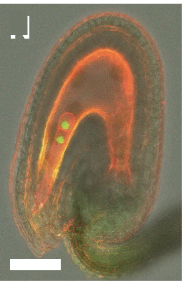 Open access visualization of Microscopy, Callose Deposition, Single Fertilization, Ovules, WOX2p::H2B-GFP+WOX2p::LTI-tdTomato