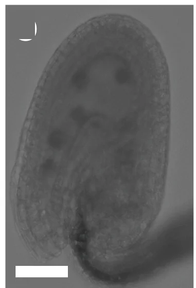 Open access visualization of Microscopy, Callose Deposition, Single Fertilization, Ovules, Bright-Field Image