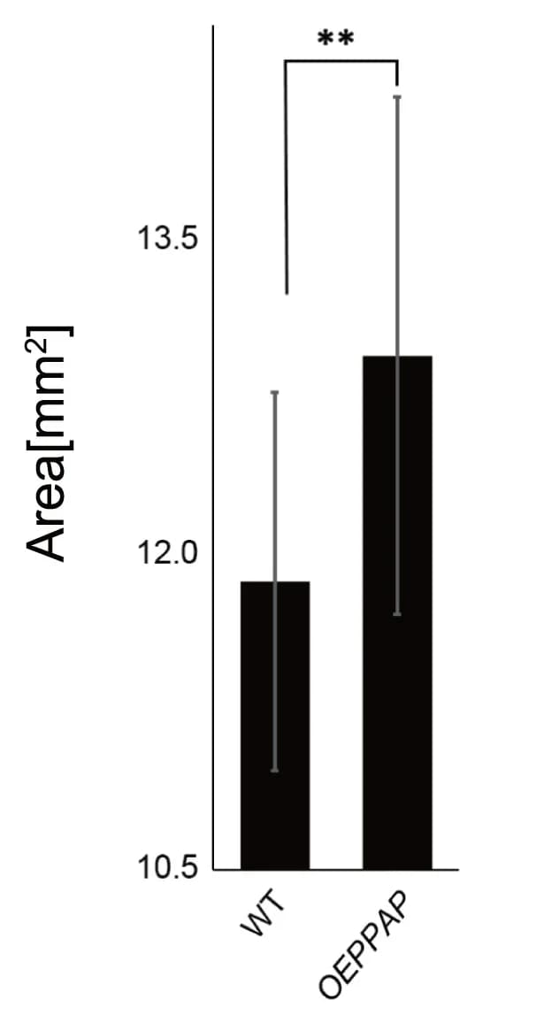 Open access visualization of Bar Plot, Error Bars, Rice Seed Size, Overexpression Line