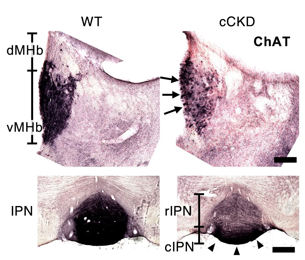 Open access visualization of Microscopy, ChAT, Hb, IPN, Wild Type Mouse