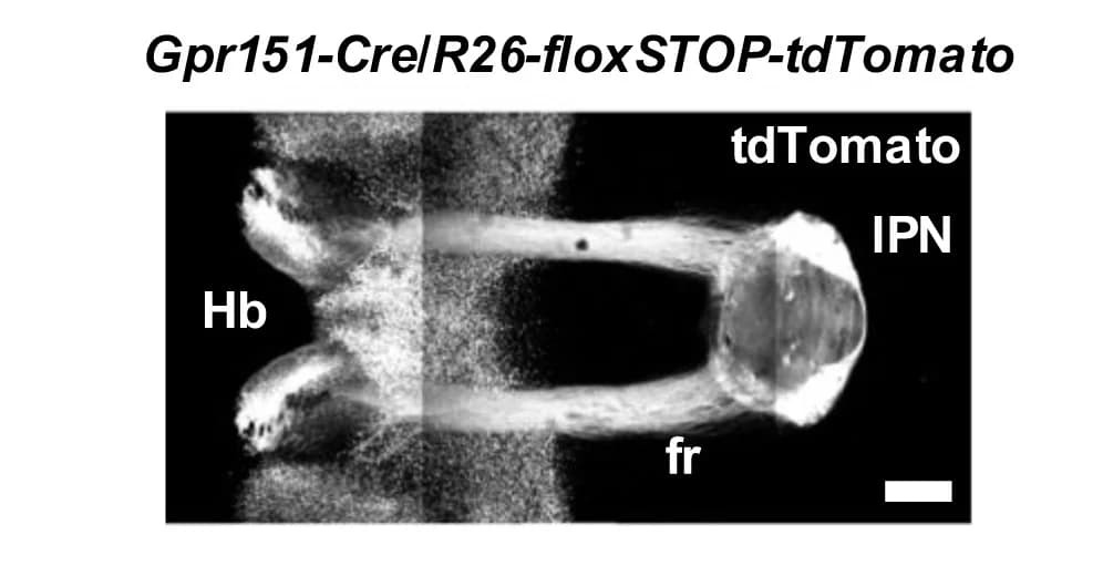 Open access visualization of Microscopy, Hb, fr, IPN, Paracoronal Brain Slice