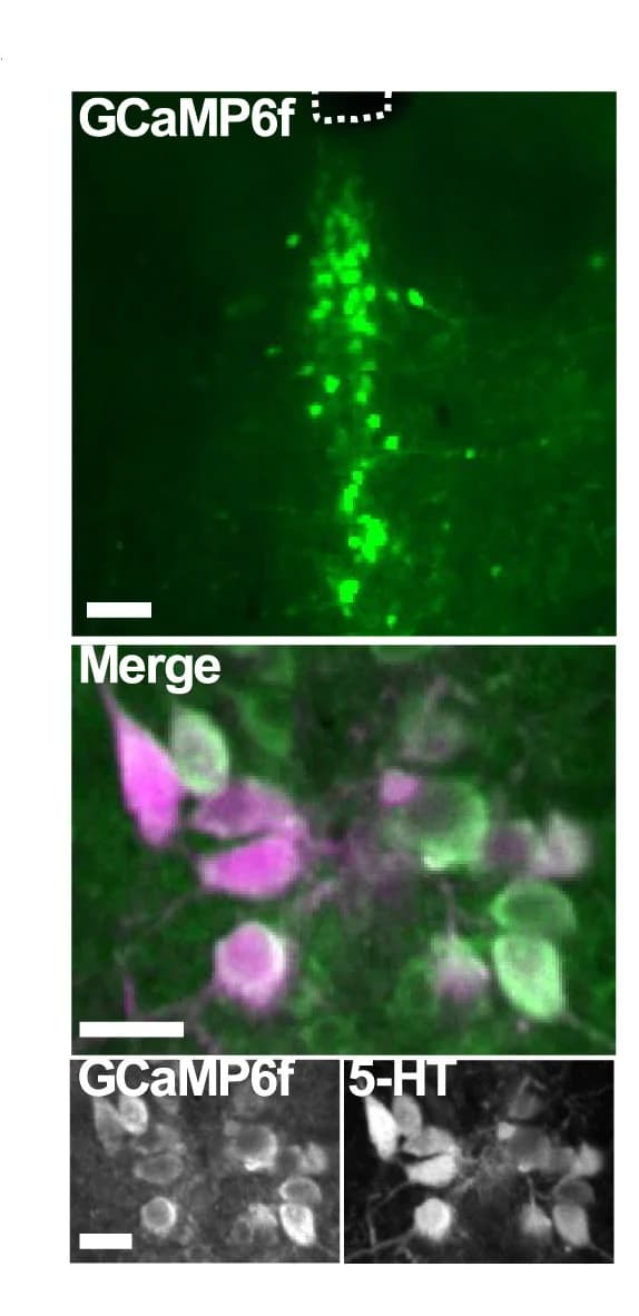 Open access visualization of Microscopy, Photo, GCaMP6f, 5-HT Neurons, MnR