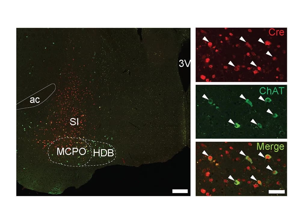 Open access visualization of Microscopy, Neurons, SI, MCPO, HDB