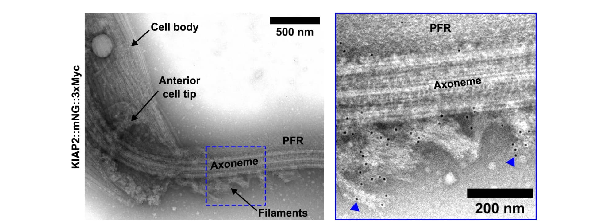 Open access visualization of Microscopy, KIAP2 Ultrastructure, Immunogold Labeling, Gold Particles, Filaments
