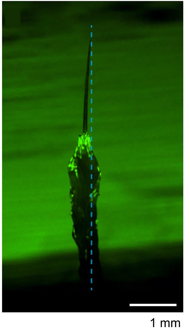 Open access visualization of Microscopy, Photo, Worms, GFP, Pharynxes