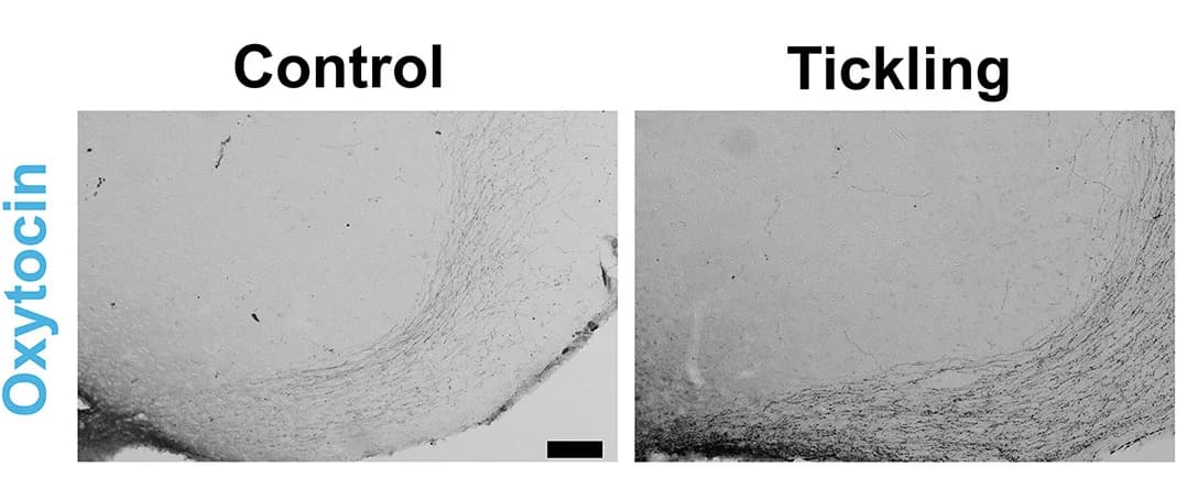 Open access visualization of Microscopy, Oxytocin, Vasopressin, Immunoreactive Fibers, VMHvl