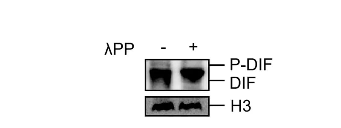 Open access visualization of Gel, DIF, Phosphorylated DIF, Lambda Protein Phosphatase, PP Treatment