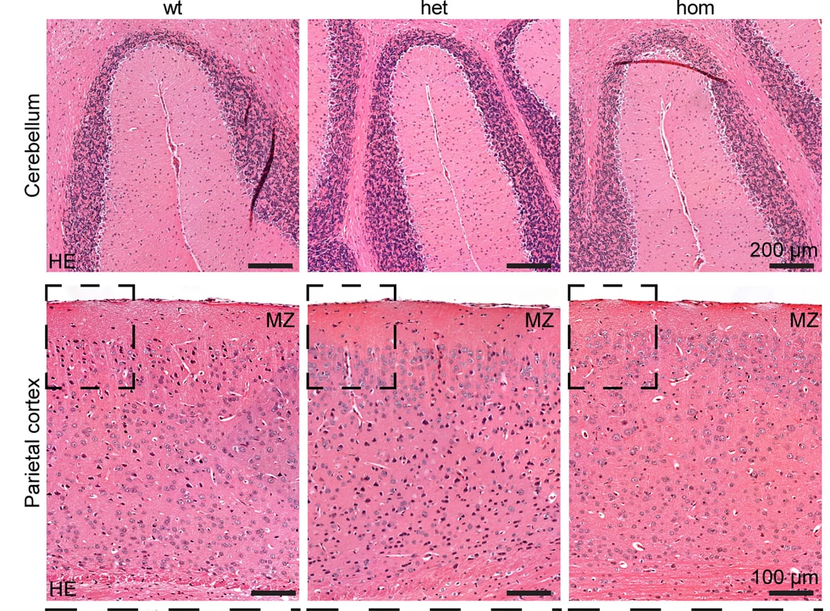 Open access visualization of Microscopy, Histopathology, H&E Staining, Wild-type, Heterozygous