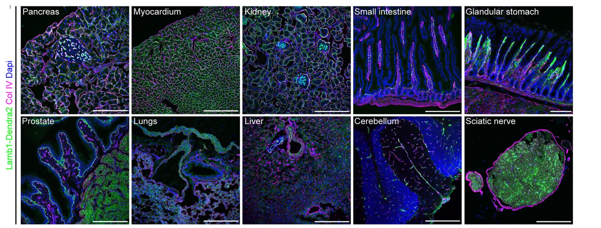 Open access visualization of Microscopy, Immunofluorescence, Collagen IV, Heterozygous, Organs