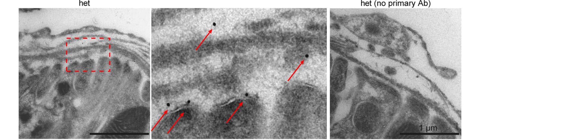 Open access visualization of Microscopy, Immunogold Staining, Heterozygous, Kidney, Antibody