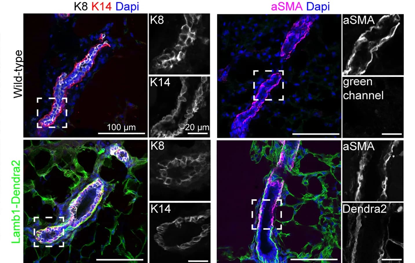 Open access visualization of Microscopy, Immunofluorescence Staining, Keratin 8, Keratin 14, aSMA