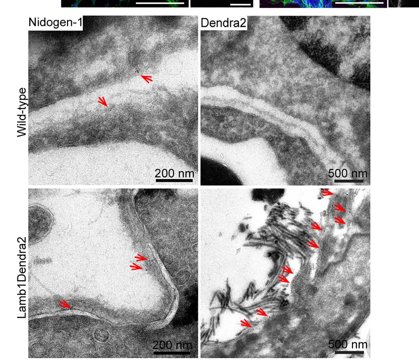 Open access visualization of Microscopy, Immunogold Staining, Nidogen-1, Dendra2, Wild-type