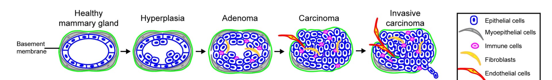 Open access visualization of Workflow, Illustration, Schematic Drawing, PyMT Tumor, Tumor Progression