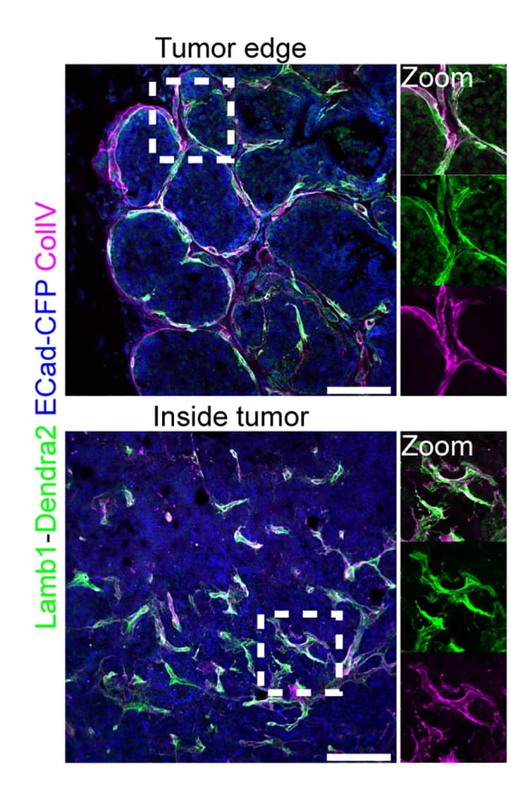 Open access visualization of Microscopy, Immunofluorescence Staining, Collagen IV, PyMT ECad-CFP Lamb1Dendra2, Tumors