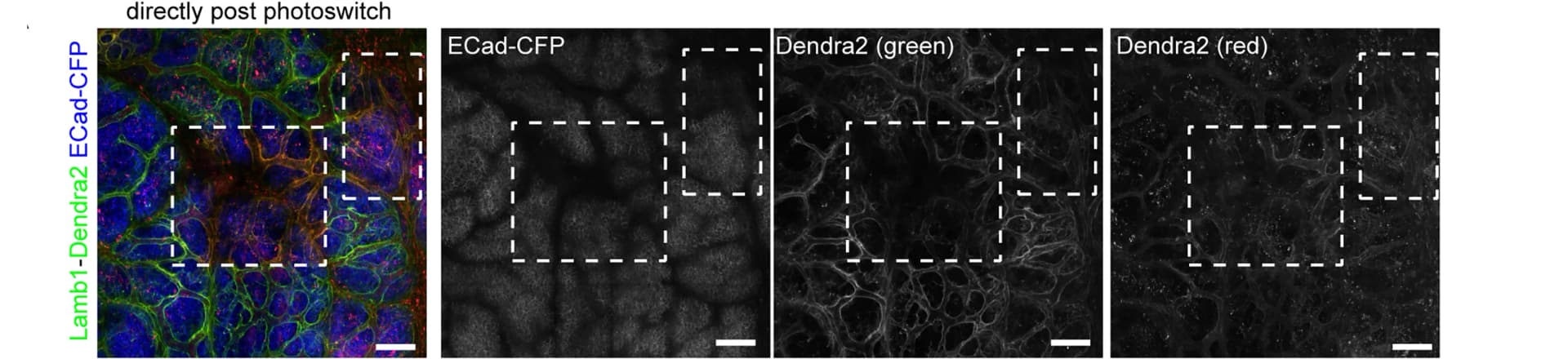 Open access visualization of Microscopy, Mice, Tumors, Epithelial Tumor Cells, Basement Membranes