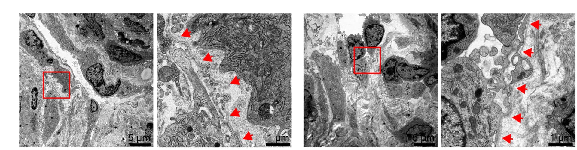 Open access visualization of Microscopy, Electron microscopy, Tumors, Stromal-cell-BM model, Cancer-cell-BM model